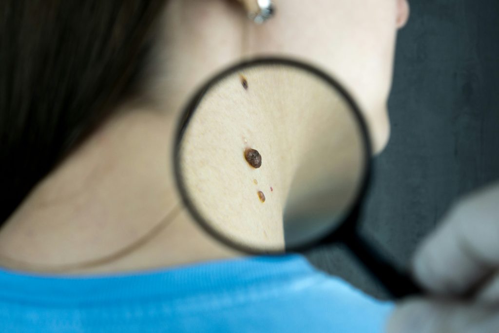 what can a dermatologist do